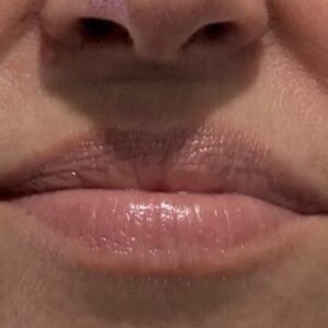 Close-up of a person's mouth and nose, showing pink glossy lips and visible textures.