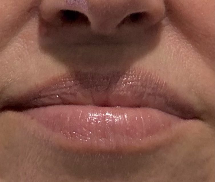 Close-up of a person's mouth and nose, showing pink glossy lips and visible textures.